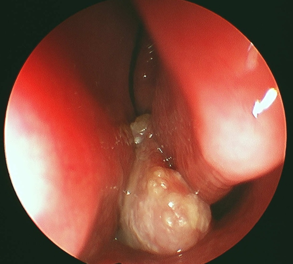 SENR_caso_072015_imagen