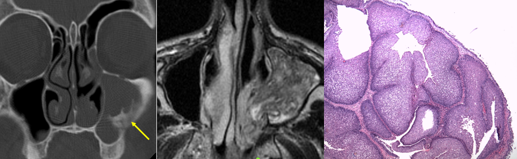 SENR_leyenda2_072015