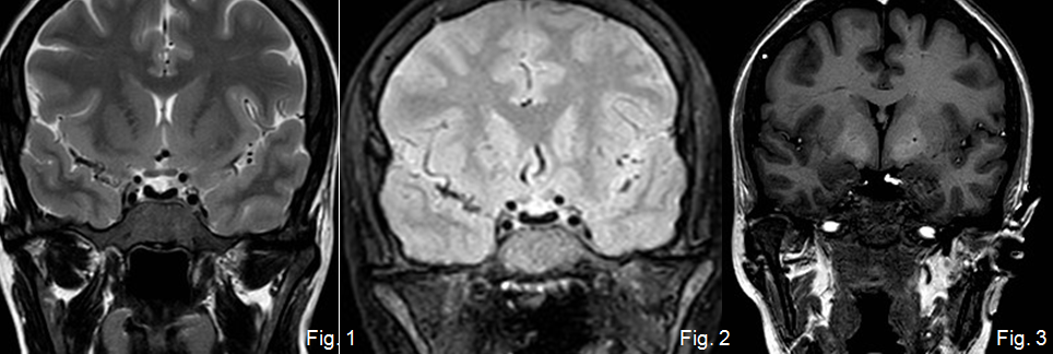 SENR_caso_mes_desaio_0915