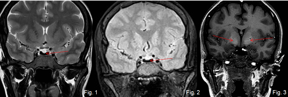SENR_caso_mes_leyendas_092015