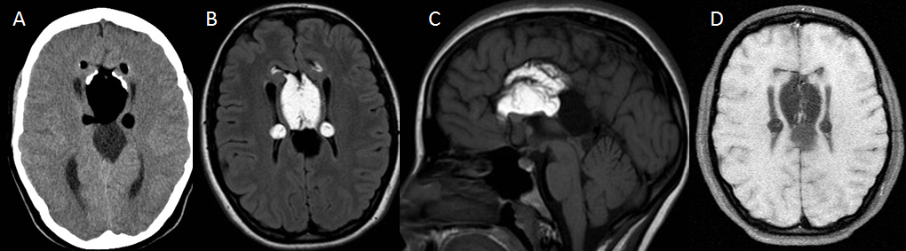 SENR_caso_prox_desafio_102015