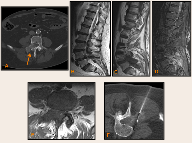 SENR_prox_des_102015