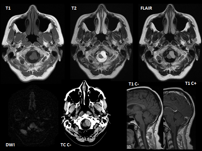 SENR_prox_des_112015