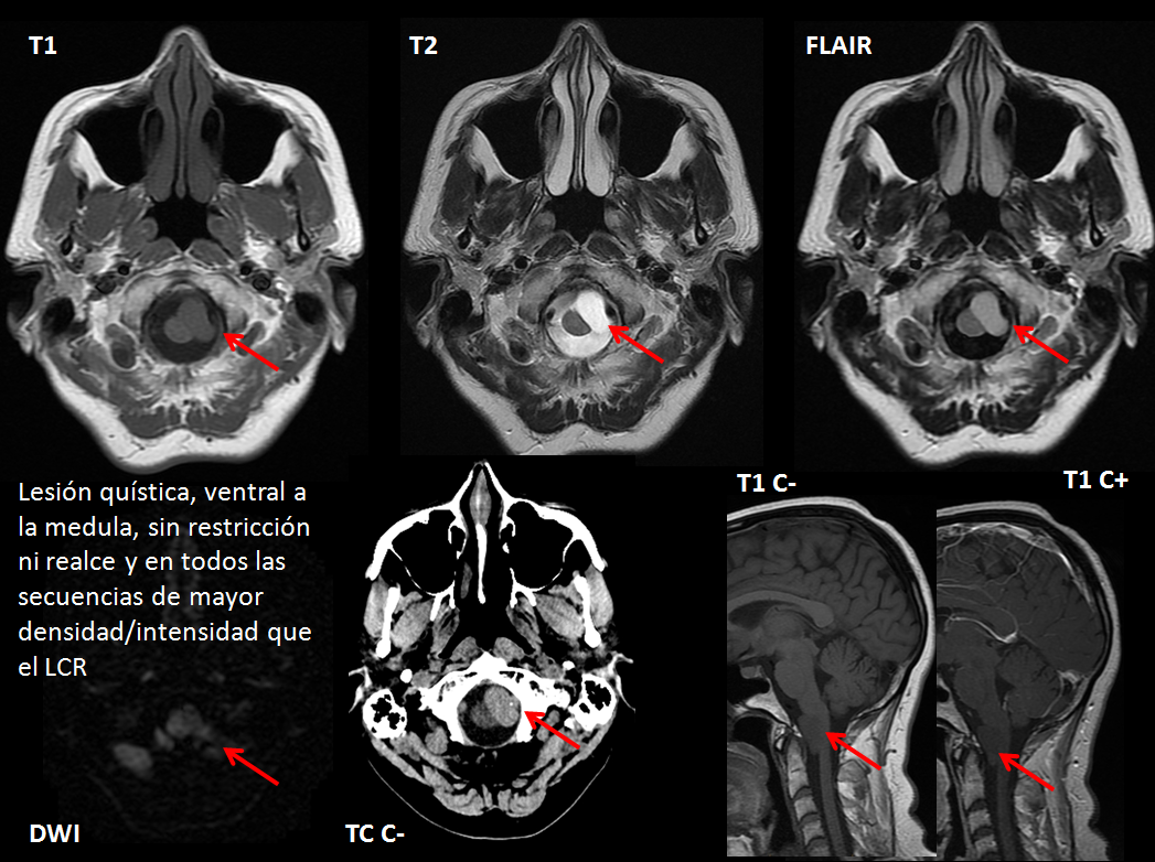 SENR_leyendas_122015