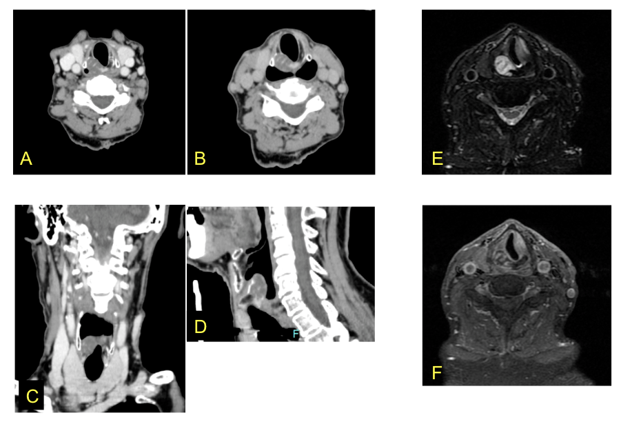 Imagen caso Febrero 2016