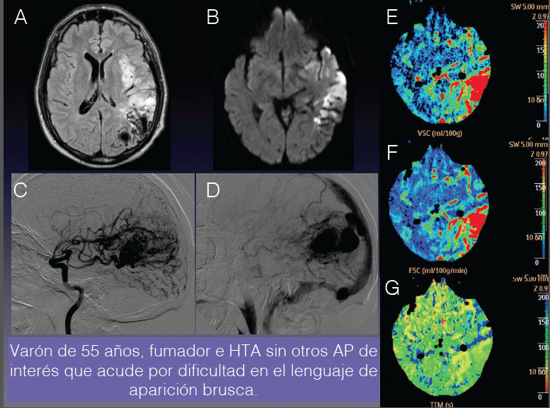 Imagen caso Marzo 2016